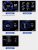KIMISS Head Up Display HUD para coche, pantalla de 3″ OBD2 + GPS, medidor inteligente, velocímetro, turbo, RPM y alarma para coche y camión